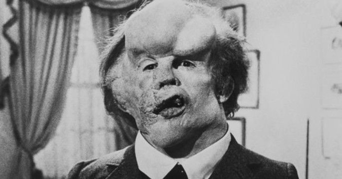 Fotograma de la película El hombre elefante